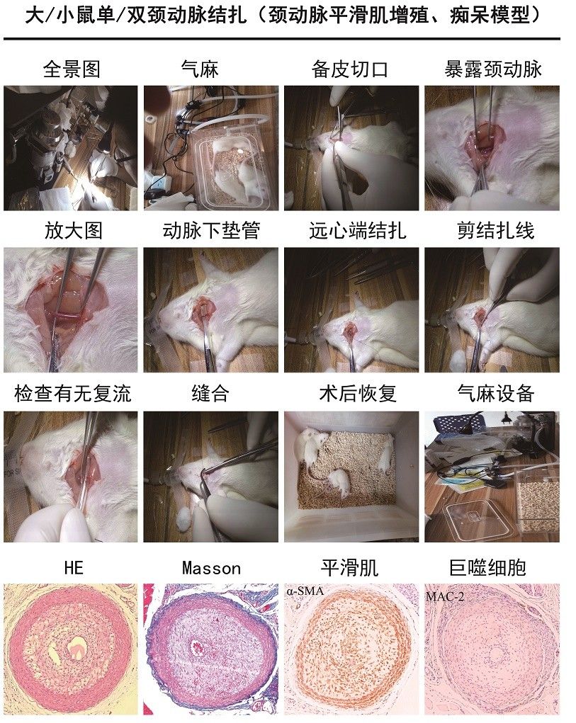 頸動(dòng)脈平滑肌增殖 、癡呆模型 