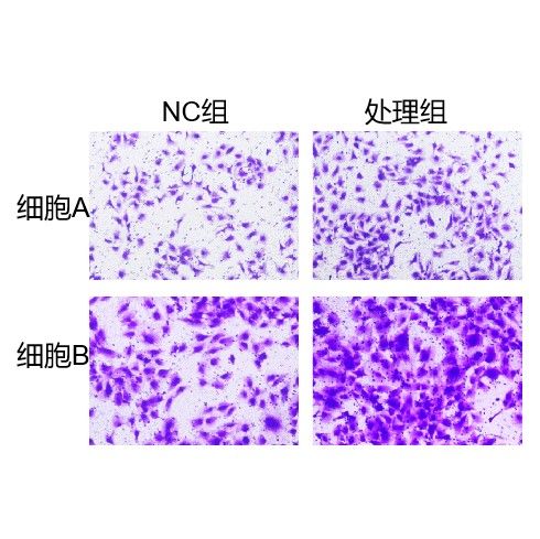 Transwell細(xì)胞遷移