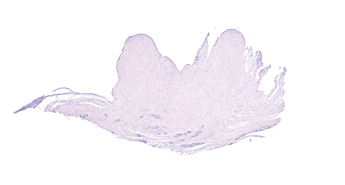 人滑膜IHC